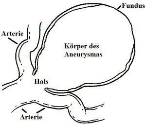 Teile eines Aneurysma