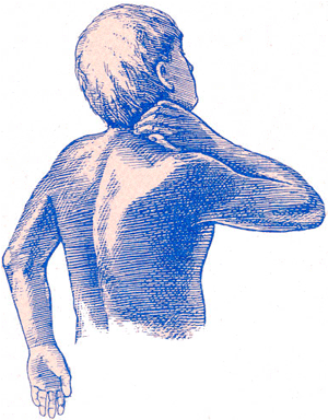 Chronische nackenschmerzen