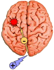 Stimulation of the brain or of the PNS