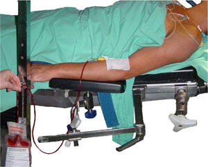 Acute normovolemic hemodilutie in de operatiekamer