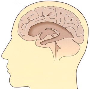 Ventriculaire systeem dat hersenvocht verzamelt waardoor hydrocephalus