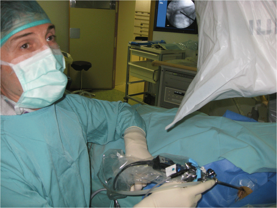 Intraoperatieve beeldvorming met endoscopie systeem in de plaats