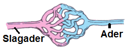 Telangiectasia Brain