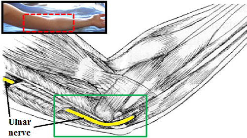 Schematisk anatomi av ulnarisnerven vid armbågen