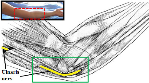Schematische Anatomie N. ulnaris am Ellenbogen